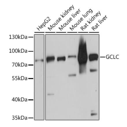 Western Blot - Anti-GCLC Antibody (A91041) - Antibodies.com