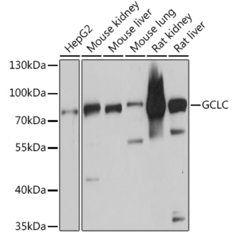 Western Blot - Anti-GCLC Antibody (A91041) - Antibodies.com