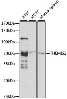 Western blot analysis of extracts of various cell lines, using Anti-THEMIS2 Antibody (A15355) at 1:1,000 dilution.
Secondary antibody: Goat Anti-Rabbit IgG (H+L) (HRP) (AS014) at 1:10,000 dilution.
Lysates / proteins: 25µg per lane.
Blocking buffer: 3% non-fat dry milk in TBST.
Detection: ECL Basic Kit (RM00020).
Exposure time: 30s.