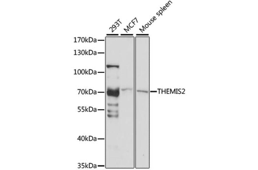 Western Blot - Anti-ICB1 Antibody (A91042) - Antibodies.com