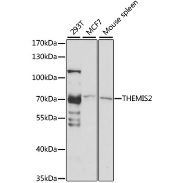 Western Blot - Anti-ICB1 Antibody (A91042) - Antibodies.com