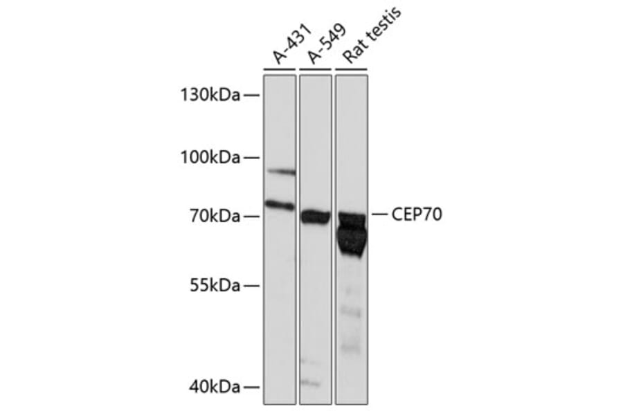 Western Blot - Anti-CEP70 Antibody (A91043) - Antibodies.com