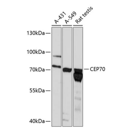 Western Blot - Anti-CEP70 Antibody (A91043) - Antibodies.com