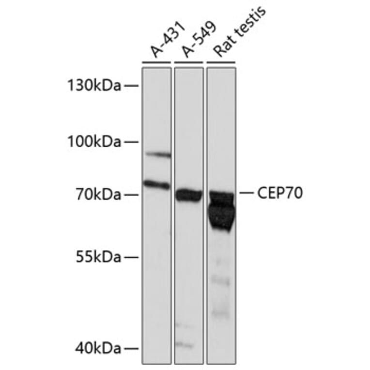 Western Blot - Anti-CEP70 Antibody (A91043) - Antibodies.com