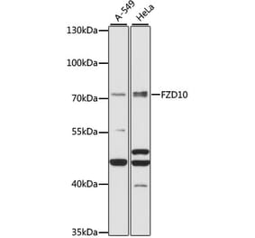 Western Blot - Anti-FZD10 Antibody (A91045) - Antibodies.com