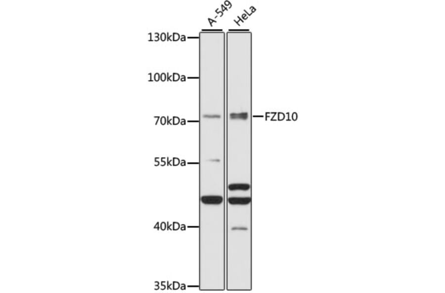 Western Blot - Anti-FZD10 Antibody (A91045) - Antibodies.com