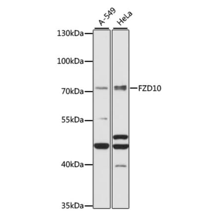 Western Blot - Anti-FZD10 Antibody (A91045) - Antibodies.com