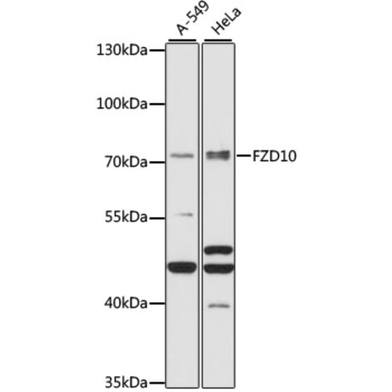 Western Blot - Anti-FZD10 Antibody (A91045) - Antibodies.com