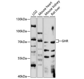 Western Blot - Anti-Growth hormone receptor Antibody (A91047) - Antibodies.com