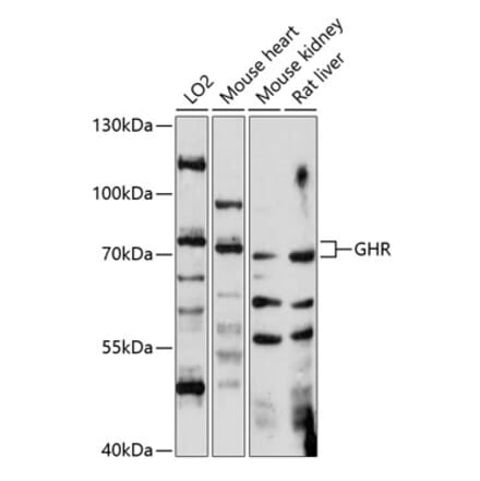 Western Blot - Anti-Growth hormone receptor Antibody (A91047) - Antibodies.com