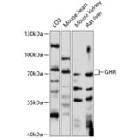 Western Blot - Anti-Growth hormone receptor Antibody (A91047) - Antibodies.com