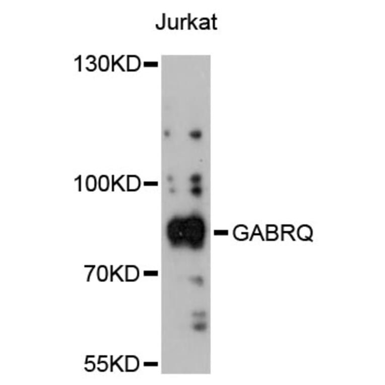 Western Blot - Anti-GABRQ Antibody (A13226) - Antibodies.com