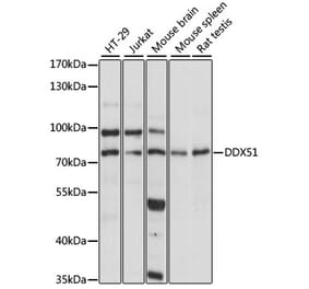Western Blot - Anti-DDX51 Antibody (A91051) - Antibodies.com
