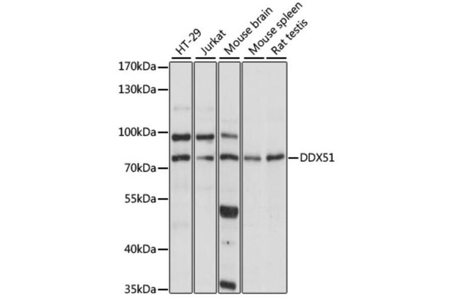 Western Blot - Anti-DDX51 Antibody (A91051) - Antibodies.com