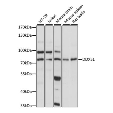 Western Blot - Anti-DDX51 Antibody (A91051) - Antibodies.com