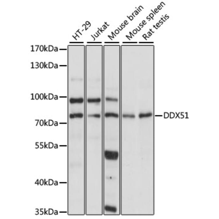 Western Blot - Anti-DDX51 Antibody (A91051) - Antibodies.com