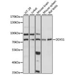 Western Blot - Anti-DDX51 Antibody (A91051) - Antibodies.com