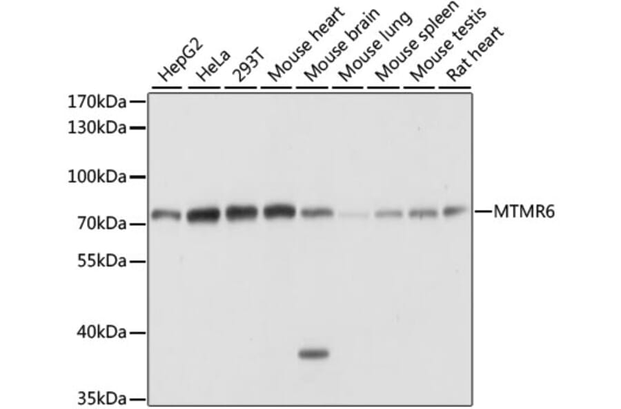 Western Blot - Anti-MTMR6 Antibody (A91052) - Antibodies.com