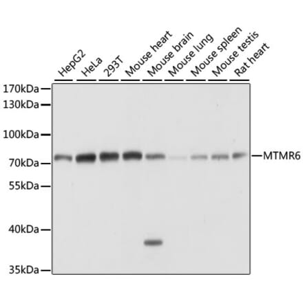 Western Blot - Anti-MTMR6 Antibody (A91052) - Antibodies.com