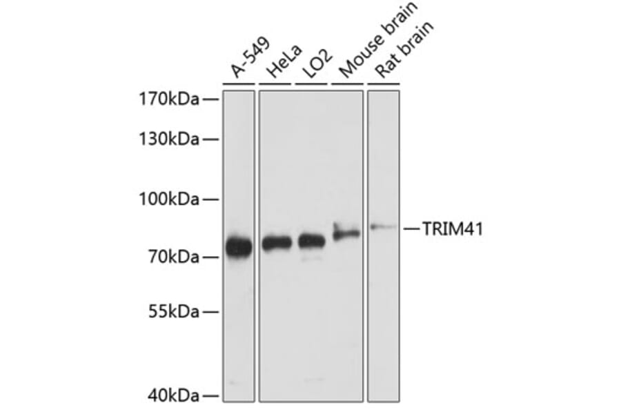 Western Blot - Anti-TRIM41 Antibody (A91053) - Antibodies.com