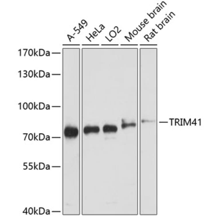 Western Blot - Anti-TRIM41 Antibody (A91053) - Antibodies.com