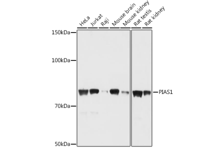 Western Blot - Anti-PIAS1 Antibody (A91054) - Antibodies.com