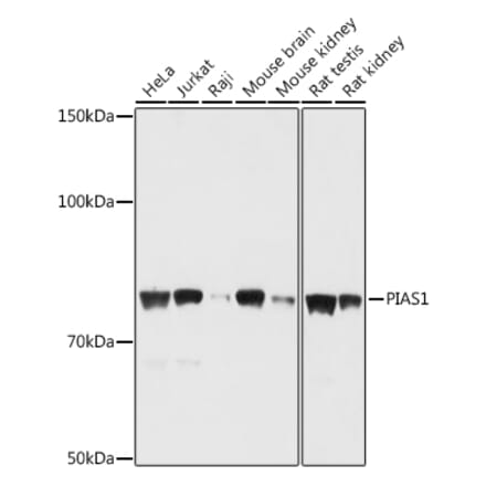 Western Blot - Anti-PIAS1 Antibody (A91054) - Antibodies.com