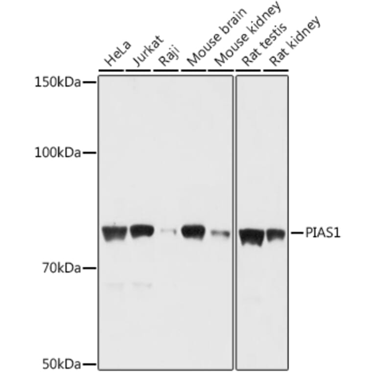 Western Blot - Anti-PIAS1 Antibody (A91054) - Antibodies.com