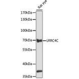 Western Blot - Anti-LRRC4C Antibody (A91055) - Antibodies.com