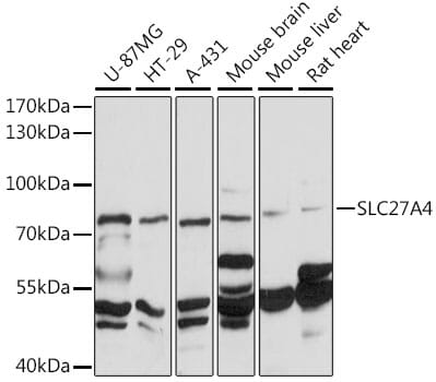 Western blot analysis of extracts of various cell lines, using Anti-SLC27A4 Antibody (A16102) at 1:1,000 dilution.
Secondary antibody: Goat Anti-Rabbit IgG (H+L) (HRP) (AS014) at 1:10,000 dilution.
Lysates / proteins: 25µg per lane.
Blocking buffer: 3% non-fat dry milk in TBST.
Detection: ECL Basic Kit (RM00020).
Exposure time: 30s.