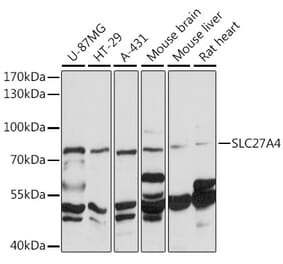 Western Blot - Anti-SLC27A4 / FATP4 Antibody (A91057) - Antibodies.com