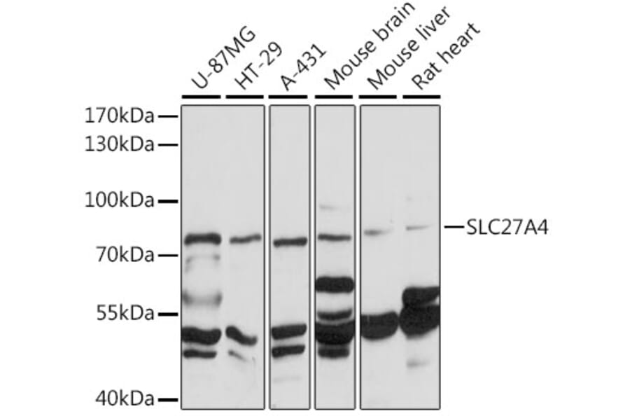 Western Blot - Anti-SLC27A4 / FATP4 Antibody (A91057) - Antibodies.com