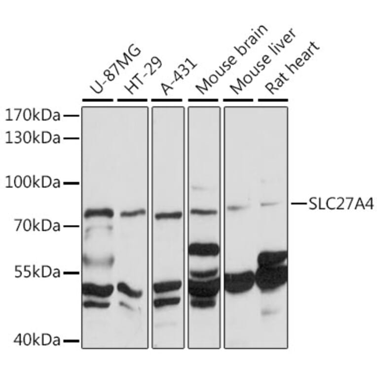 Western Blot - Anti-SLC27A4 / FATP4 Antibody (A91057) - Antibodies.com