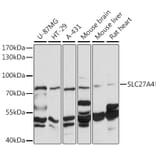 Western Blot - Anti-SLC27A4 / FATP4 Antibody (A91057) - Antibodies.com