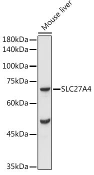 Western blot analysis of extracts of various cell lines, using Anti-SLC27A4 Antibody (A16101) at 1:1,000 dilution.
Secondary antibody: Goat Anti-Rabbit IgG (H+L) (HRP) (AS014) at 1:10,000 dilution.
Lysates / proteins: 25µg per lane.
Blocking buffer: 3% non-fat dry milk in TBST.
Detection: ECL Basic Kit (RM00020).
Exposure time: 10s.