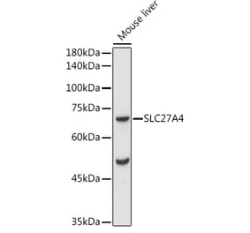 Western Blot - Anti-SLC27A4 / FATP4 Antibody (A91058) - Antibodies.com