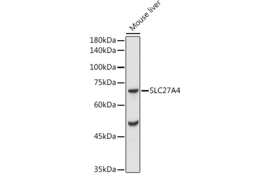 Western Blot - Anti-SLC27A4/FATP4 Antibody (A91058) - Antibodies.com