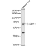 Western Blot - Anti-SLC27A4/FATP4 Antibody (A91058) - Antibodies.com