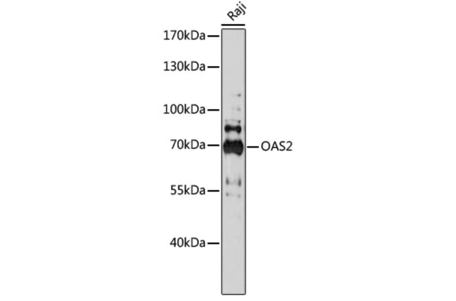 Western Blot - Anti-OAS2 Antibody (A91059) - Antibodies.com