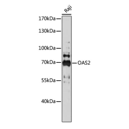 Western Blot - Anti-OAS2 Antibody (A91059) - Antibodies.com