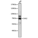 Western Blot - Anti-OAS2 Antibody (A91059) - Antibodies.com