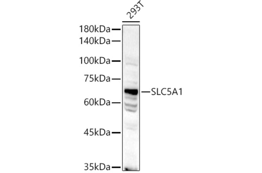 Western Blot - Anti-SGLT1 Antibody (A91061) - Antibodies.com