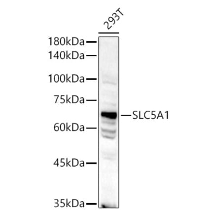 Western Blot - Anti-SGLT1 Antibody (A91061) - Antibodies.com