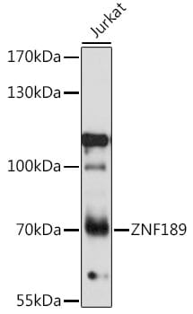 Western blot analysis of extracts of Jurkat cells, using Anti-ZNF189 Antibody (A16446) at 1:1,000 dilution.
Secondary antibody: Goat Anti-Rabbit IgG (H+L) (HRP) (AS014) at 1:10,000 dilution.
Lysates / proteins: 25µg per lane.
Blocking buffer: 3% non-fat dry milk in TBST.
Detection: ECL Basic Kit (RM00020).
Exposure time: 10s.