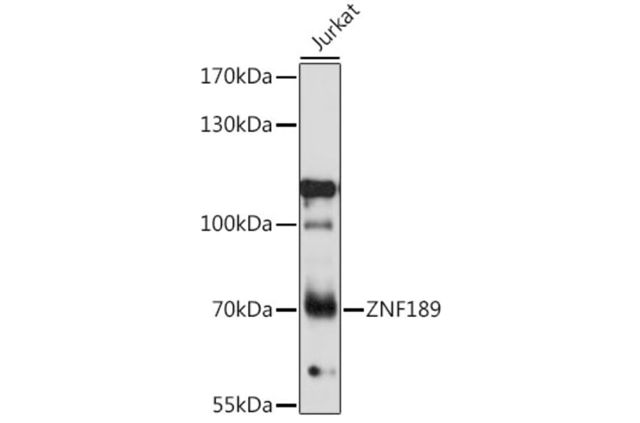 Western Blot - Anti-ZNF189 Antibody (A91062) - Antibodies.com