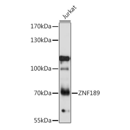 Western Blot - Anti-ZNF189 Antibody (A91062) - Antibodies.com