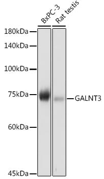 Western blot analysis of extracts of various cell lines, using Anti-GALNT3 Antibody (A13985) at 1:1,000 dilution.
Secondary antibody: Goat Anti-Rabbit IgG (H+L) (HRP) (AS014) at 1:10,000 dilution.
Lysates / proteins: 25µg per lane.
Blocking buffer: 3% non-fat dry milk in TBST.
Detection: ECL Basic Kit (RM00020).
Exposure time: 30s.