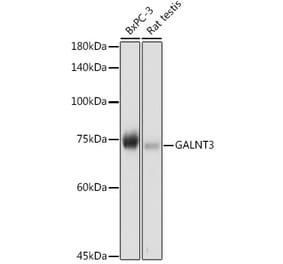 Western Blot - Anti-GALNT3 Antibody (A91063) - Antibodies.com