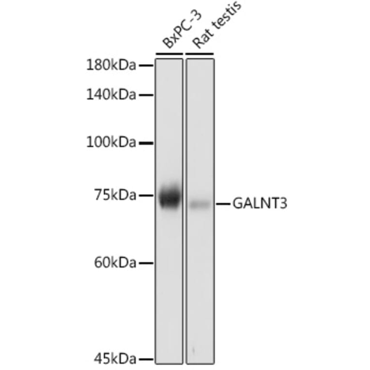 Western Blot - Anti-GALNT3 Antibody (A91063) - Antibodies.com