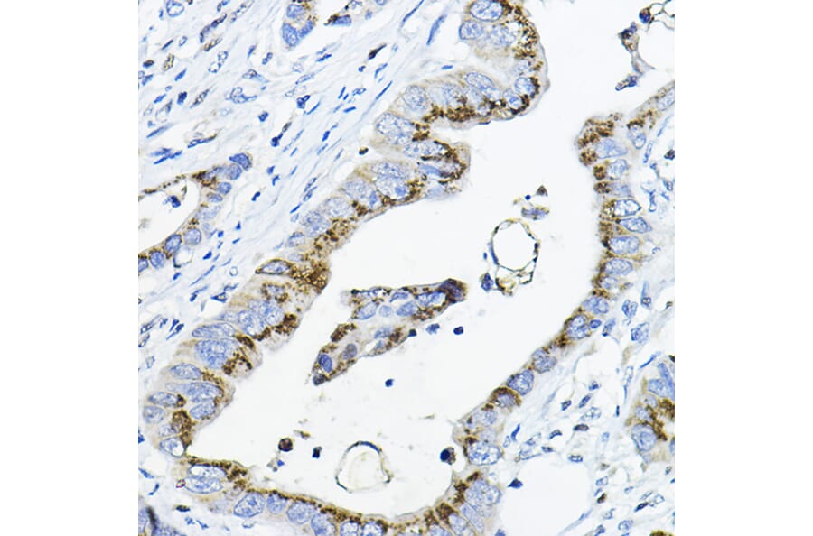 Immunohistochemistry - Anti-GALNT3 Antibody (A91063) - Antibodies.com